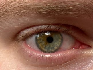 persons eye in close up